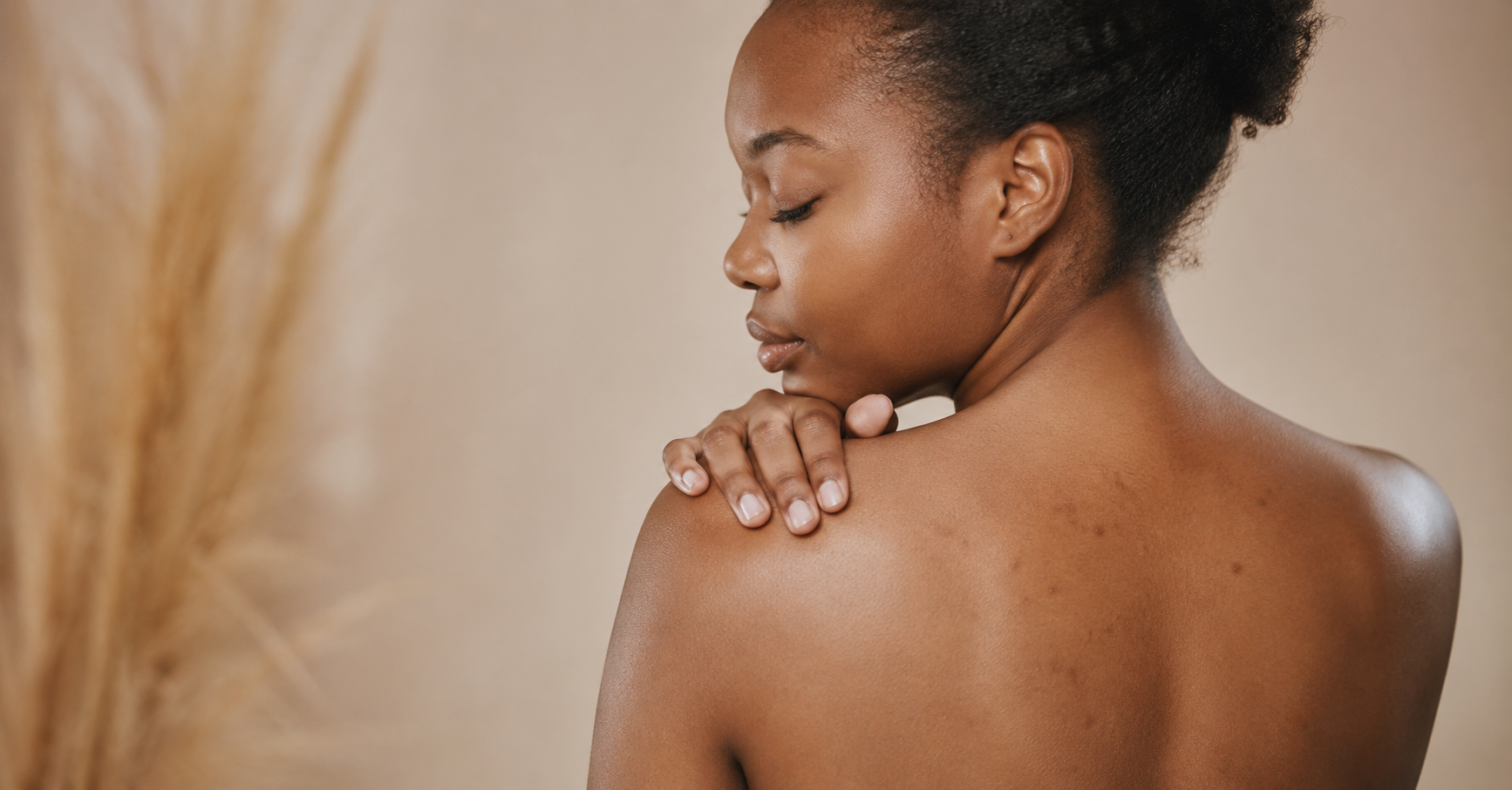 How to Get Rid of Back Acne Fast: A Practical Routine for Hormonal Body Acne
