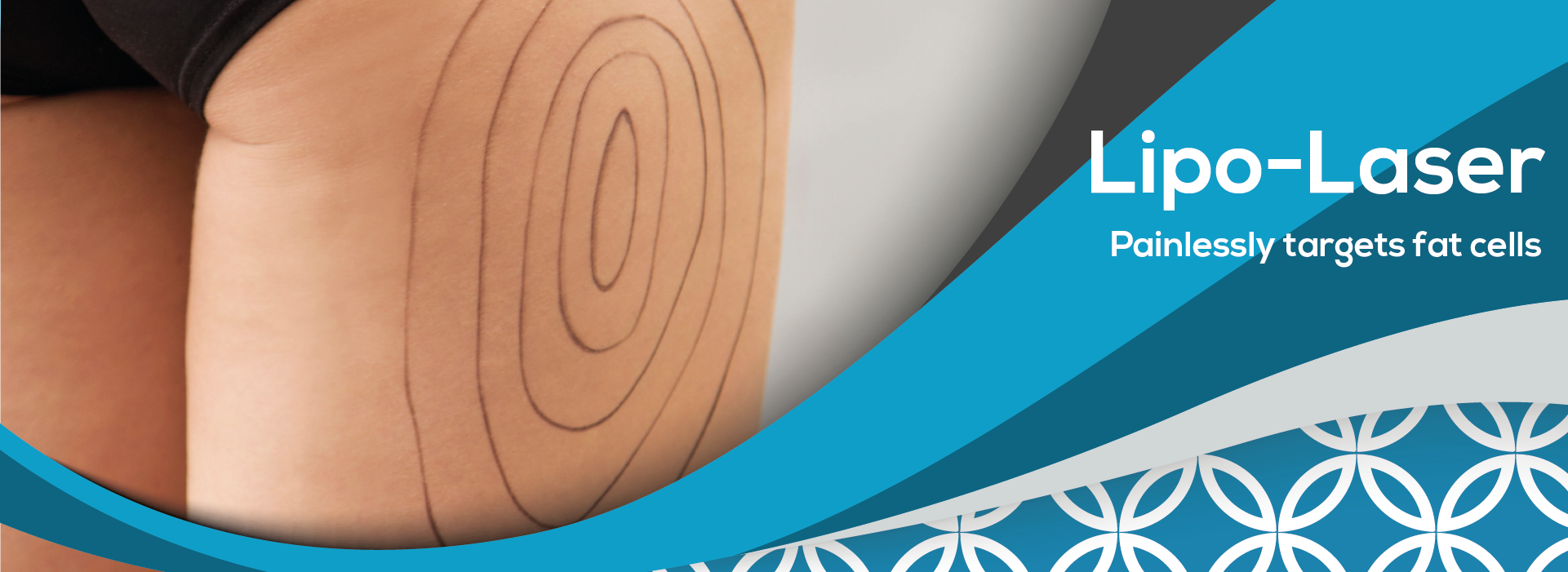 LipoLaser Body Treatments Transform your body without surgery, Fat